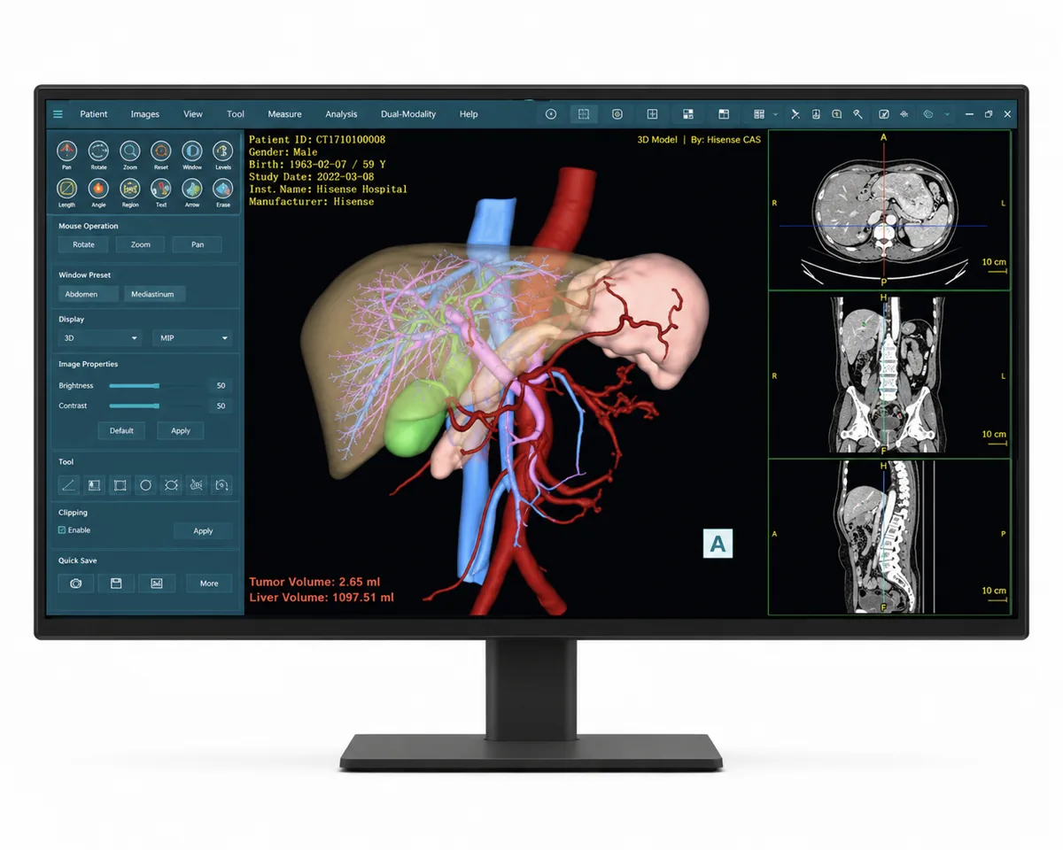 Hisense Medical CAS Software