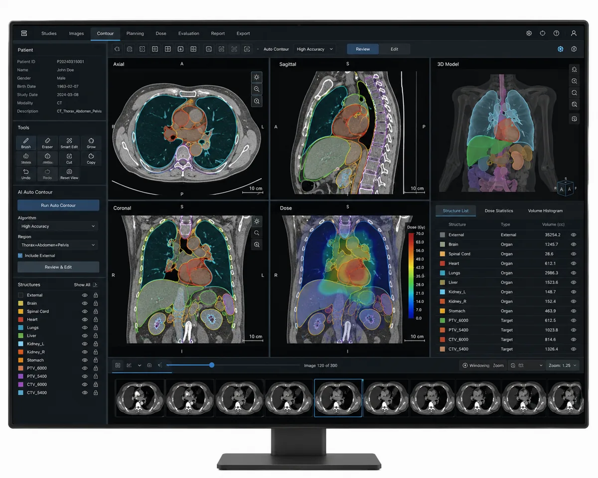 Auto Contouring Software